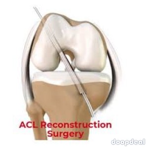 Boost Your Acl Reconstruction Surgery In Navi Mumbai With These Tips